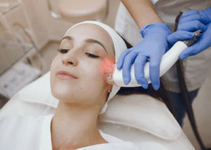 laser scar removal dark skin 