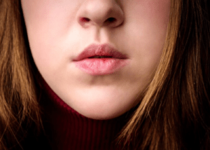 best lip balm for chapped lips 