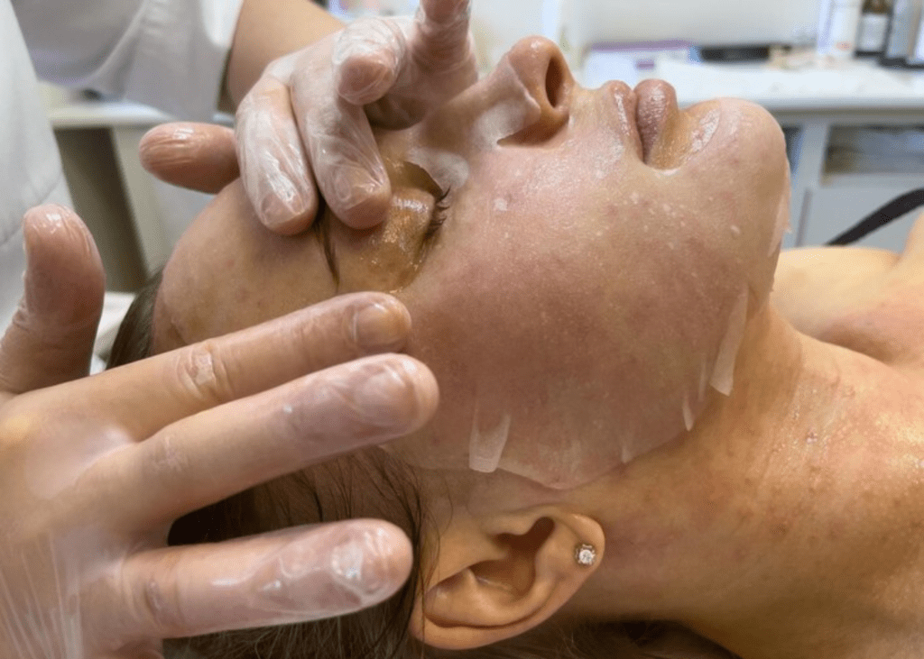 Uneven Skin Tone Treatment
